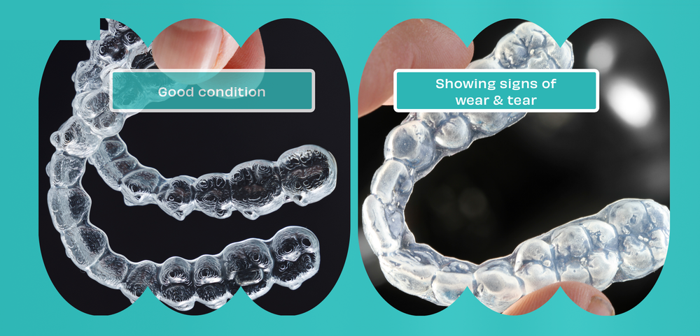 Comparing a retainer in good condition with one showing signs of wear and tear